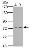 Anti-cGK1 antibody used in Western Blot (WB). GTX101096