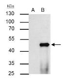 Anti-PPAR alpha antibody used in Immunoprecipitation (IP). GTX101098