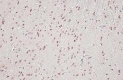 Anti-PPAR alpha antibody used in IHC (Paraffin sections) (IHC-P). GTX101098