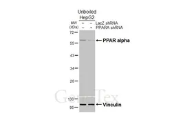 Anti-PPAR alpha antibody used in Western Blot (WB). GTX101098
