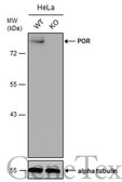 Anti-POR antibody [N1N3] used in Western Blot (WB). GTX101099