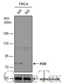 Anti-POR antibody [N2C2], Internal used in Western Blot (WB). GTX101100