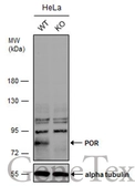 Anti-POR antibody [C2C3], C-term used in Western Blot (WB). GTX101101
