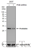 Anti-Prohibitin antibody used in Western Blot (WB). GTX101105