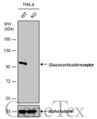 Anti-Glucocorticoid Receptor antibody used in Western Blot (WB). GTX101120