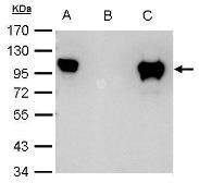 Anti-Glucocorticoid Receptor antibody used in Immunoprecipitation (IP). GTX101120