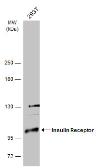 Anti-Insulin Receptor antibody used in Western Blot (WB). GTX101136