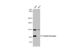 Anti-Insulin Receptor beta antibody used in Western Blot (WB). GTX101136