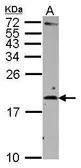Anti-IL2 antibody used in Western Blot (WB). GTX101138