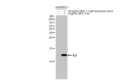 Anti-IL2 antibody used in Western Blot (WB). GTX101138