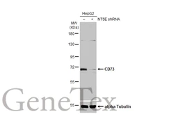 Anti-CD73 antibody [N3C3] used in Western Blot (WB). GTX101140
