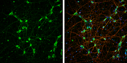 Anti-NF-L antibody used in Immunocytochemistry/ Immunofluorescence (ICC/IF). GTX101142