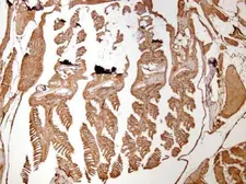 Anti-HSC70 antibody used in IHC (Paraffin sections) (IHC-P). GTX101144