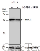 Anti-HSP27 antibody used in Western Blot (WB). GTX101145