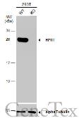 Anti-HPRT antibody used in Western Blot (WB). GTX101148