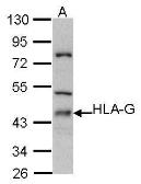 Anti-HLA-G antibody [N1C3] used in Western Blot (WB). GTX101149