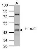 Anti-HLA-G antibody [N1C3] used in Western Blot (WB). GTX101149