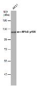 Anti-NFkB p100 antibody [C2C3], C-term used in Western Blot (WB). GTX101150