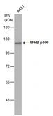 Anti-NFkB p100 antibody [C2C3], C-term used in Western Blot (WB). GTX101150
