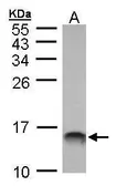 Anti-MIF antibody [N1C3] used in Western Blot (WB). GTX101162