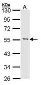 Anti-MEF2A antibody [N1N2], N-term used in Western Blot (WB). GTX101163