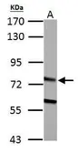 Anti-HADHA antibody used in Western Blot (WB). GTX101177
