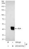 Anti-Galactosidase alpha antibody [N1C2] used in Immunoprecipitation (IP). GTX101178