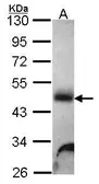 Anti-Galactosidase alpha antibody [N1C2] used in Western Blot (WB). GTX101178