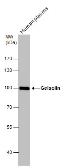 Anti-Gelsolin antibody [C2C3], C-term used in Western Blot (WB). GTX101185