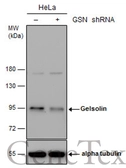 Anti-Gelsolin antibody [C2C3], C-term used in Western Blot (WB). GTX101185