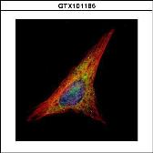 Anti-Gelsolin antibody [C2C3], C-term used in Immunocytochemistry/ Immunofluorescence (ICC/IF). GTX101185