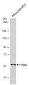 Anti-FYN antibody [N1N3] used in Western Blot (WB). GTX101189