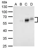 Anti-c-Fos antibody used in Western Blot (WB). GTX101196