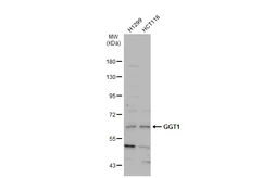 Anti-GGT1 antibody used in Western Blot (WB). GTX101198