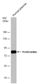 Anti-Prothrombin antibody used in Western Blot (WB). GTX101199