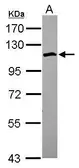 Anti-SCP1 antibody [C2C3], C-term used in Western Blot (WB). GTX101204