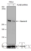 Anti-Filamin B antibody [N1], N-term used in Western Blot (WB). GTX101206