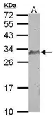 Anti-SCP3 antibody used in Western Blot (WB). GTX101207