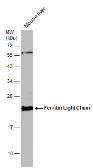 Anti-Ferritin Light Chain antibody [N1C3] used in Western Blot (WB). GTX101211