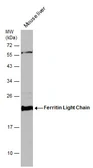 Anti-Ferritin Light Chain antibody [N1C3] used in Western Blot (WB). GTX101211