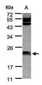 Anti-Ferritin Light Chain antibody [N1C3] used in Western Blot (WB). GTX101211