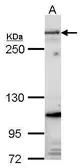 Anti-Fibrillin 1 antibody [C3], C-term used in Western Blot (WB). GTX101216