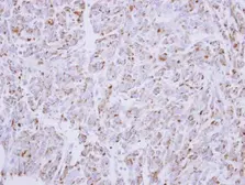Anti-G6PD antibody [N3C3] used in IHC (Paraffin sections) (IHC-P). GTX101218