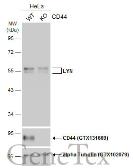 Anti-LYN antibody used in Western Blot (WB). GTX101222