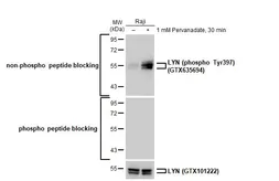 Anti-LYN antibody used in Western Blot (WB). GTX101222