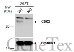 Anti-CDK2 antibody [N1C3] used in Western Blot (WB). GTX101226
