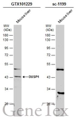 Anti-DUSP1 antibody used in Western Blot (WB). GTX101229