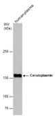 Anti-Ceruloplasmin antibody used in Western Blot (WB). GTX101231