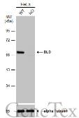 Anti-DLD antibody [N1N3] used in Western Blot (WB). GTX101232