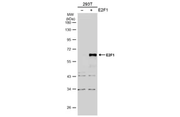 Anti-E2F1 antibody [N1N3] used in Western Blot (WB). GTX101235